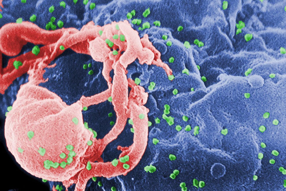 Diferencias entre SIDA y VIH