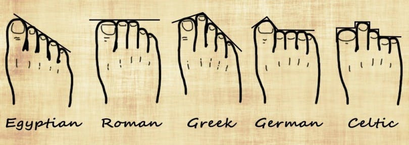 Tipos de pie diagrama