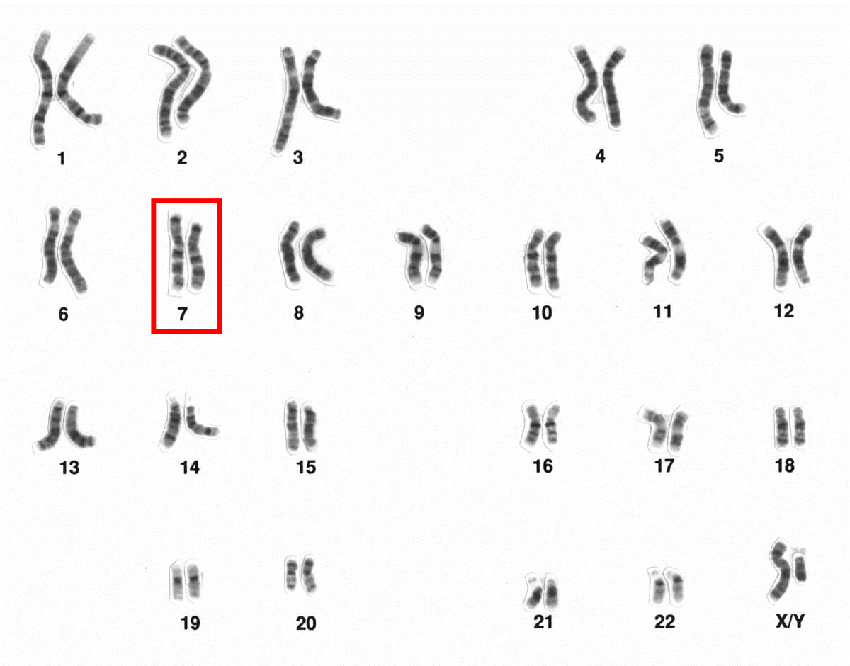 Cromosoma 7 CFRT